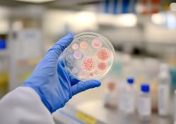 scientist analyzing bacterial-cultures in laboratory