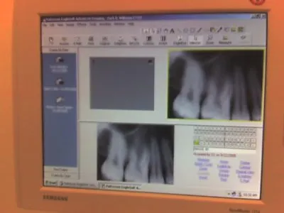 DIGITAL PATIENT RECORDS image